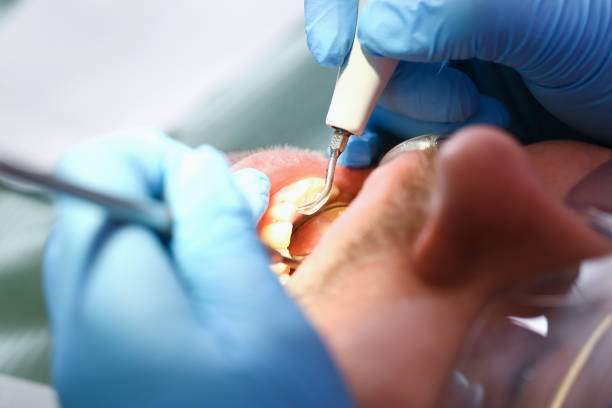 Best Emergency Treatment for Toothache in Garnett, KS