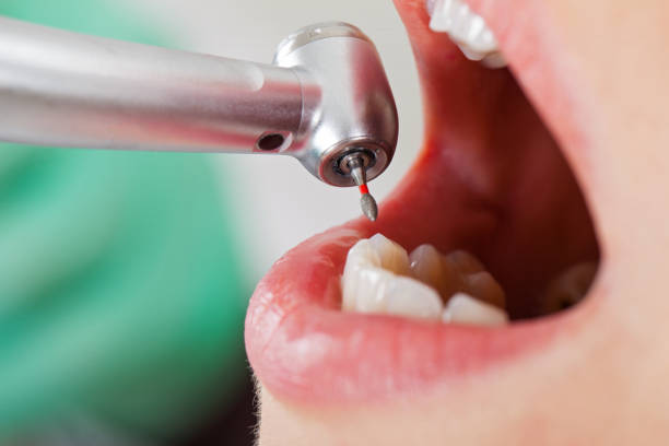 Best Emergency Treatment for Toothache in Garnett, KS